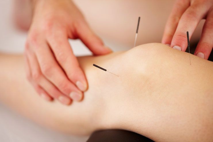 Acupuncture helps in relieving arthritis pain