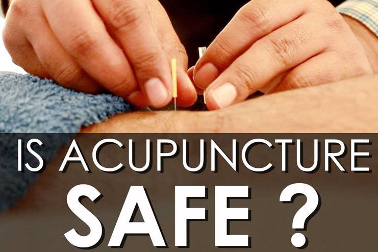 Acupuncture safe