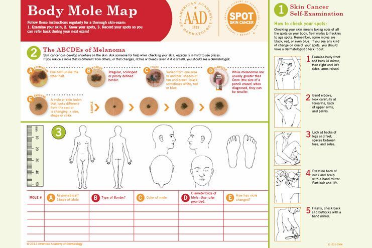 keep a schedule of moles and skin lesions in your body
