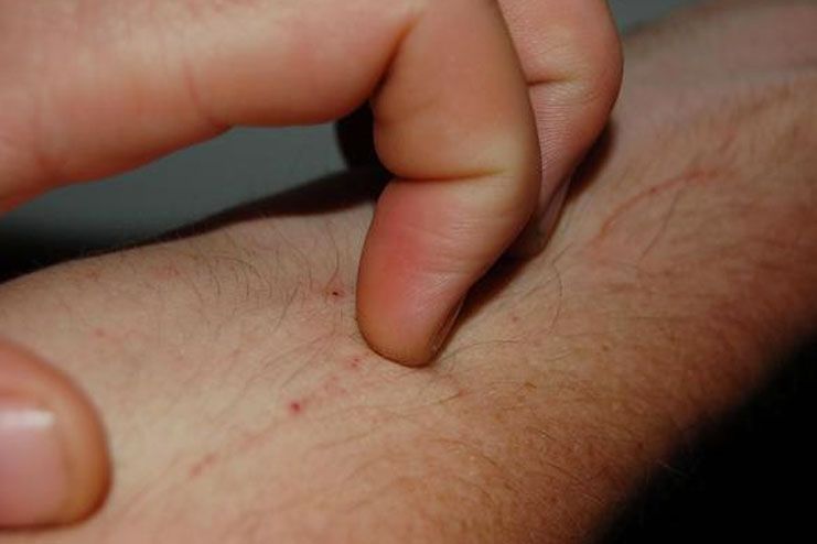 symptoms and signs of small itchy bumps on skin
