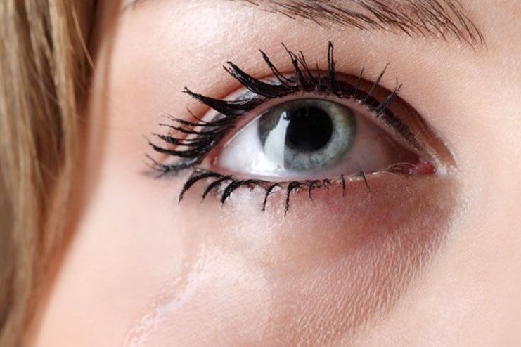 symptoms and signs of water eyes