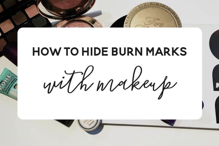 How To Hide Burns