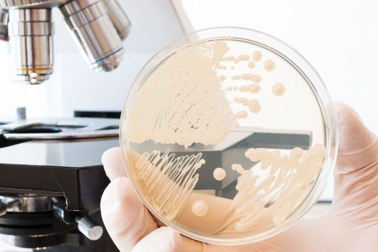 Get Rid of Yeast Infection-Yeast Infection Get Rid of Yeast Infection-Yeast Infection