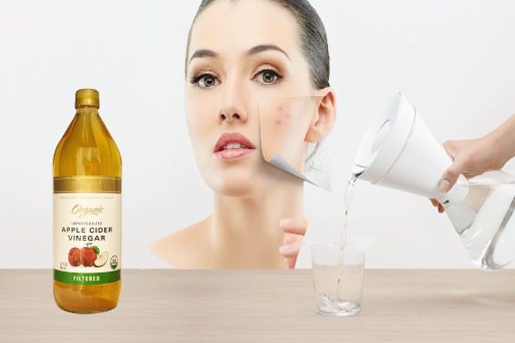 Apple cider vinegar for cystic acne