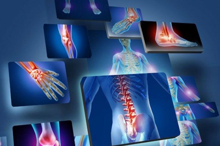 Stages Of Rheumatoid Arthritis Stages Of Rheumatoid Arthritis