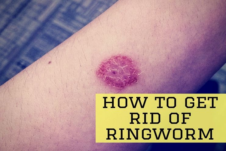 ringworm-stages-of-healing
