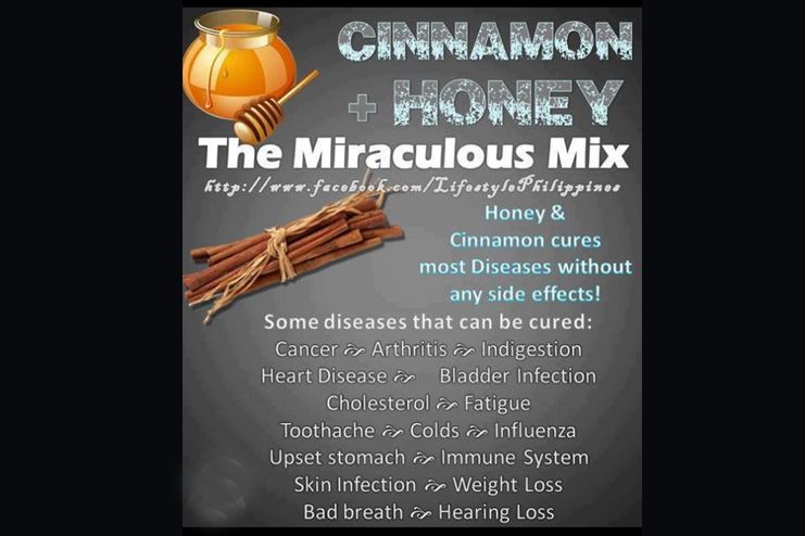 Honey and Cinnamon helps prevent cancer