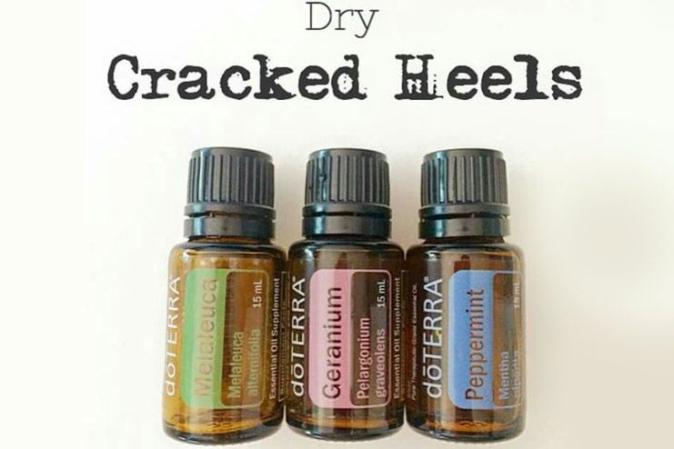 Essential oils for Dry Cracked Feet