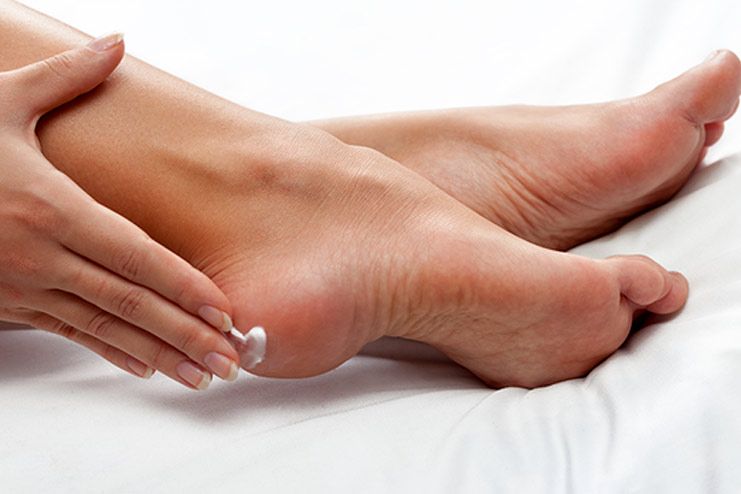 How to prevent cracked heels