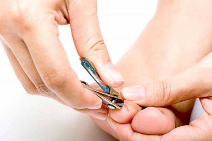 How to cut ingrown toenail