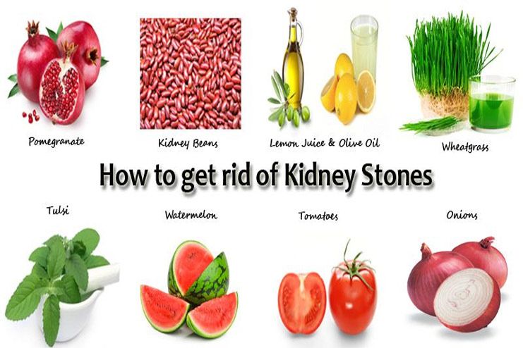 Natural Remedies for Kidney Stones That Dissolve Them