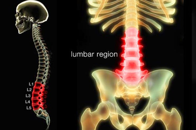 What is lower back pain