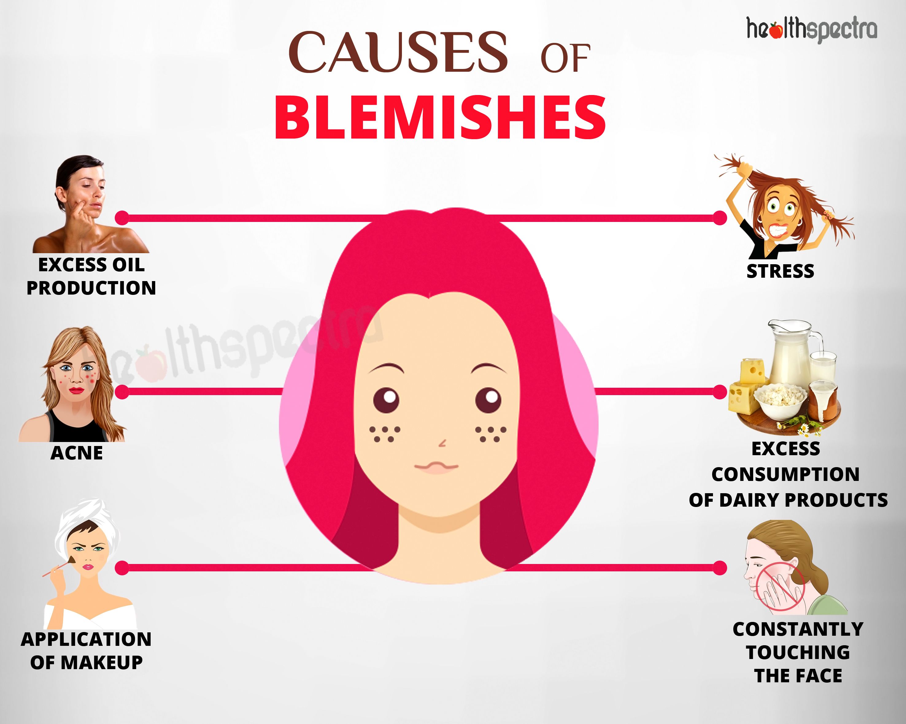 Causes of Blemishes