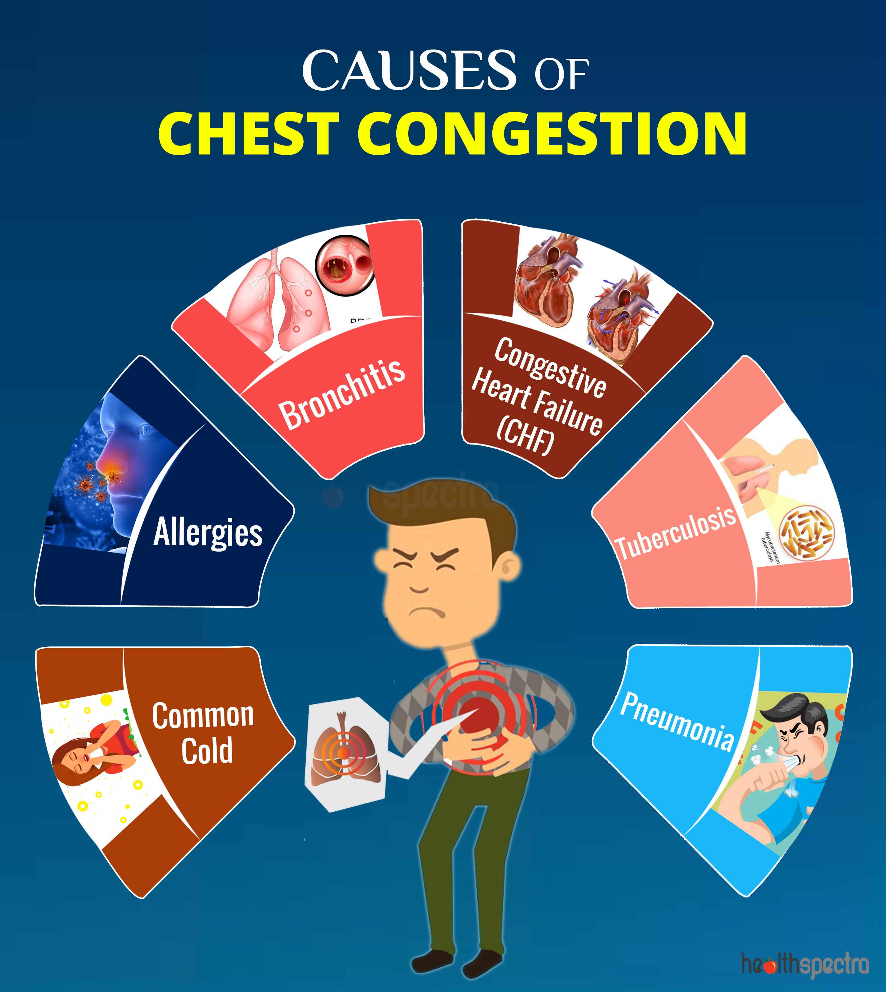 Causes of Chest Congestion