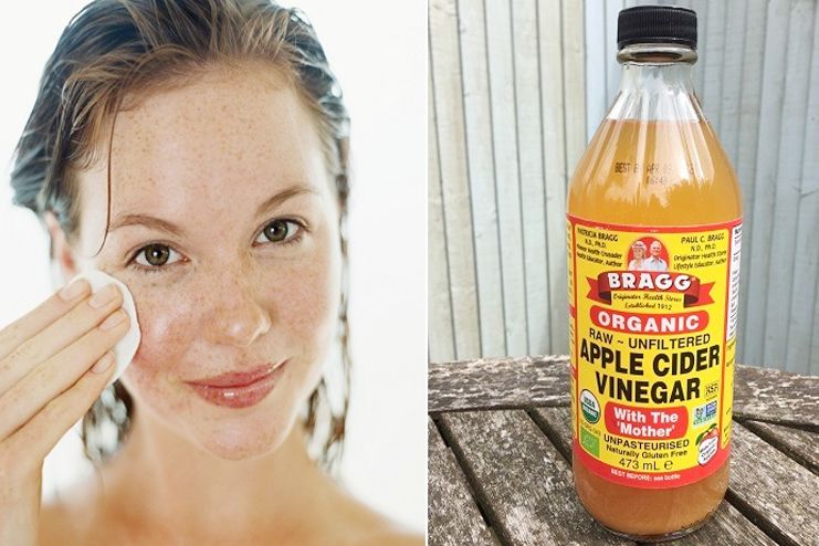 Facial Hair Removal with Apple cider vinegar