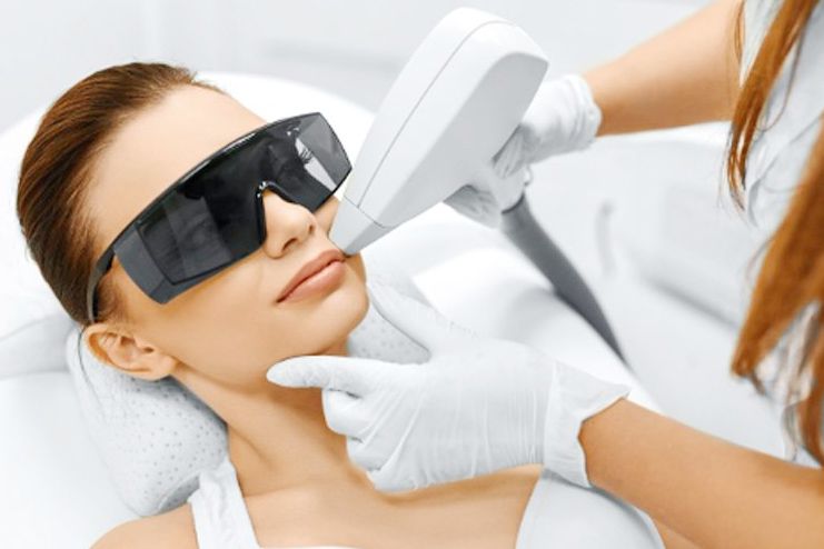 Facial Hair Removal with Laser treatment