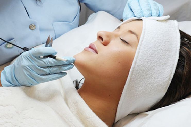 Facial Hair Removal with Electrolysis