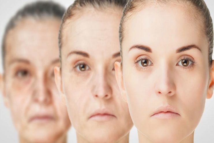 Skin aging