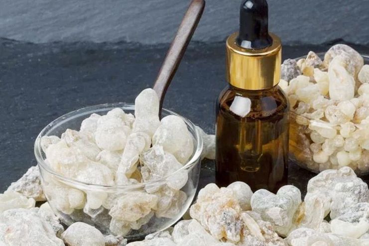 Frankincense Essential Oil for Psoriasis