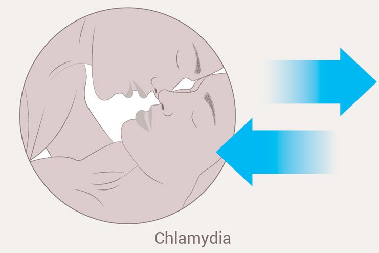 How long does Chlamydia last
