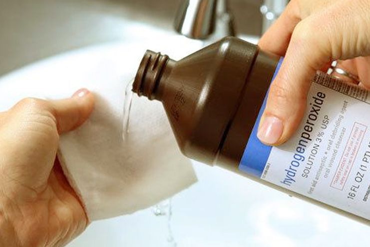 Hydrogen Peroxide for Mouth Ulcers