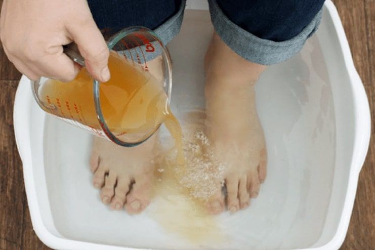 Apple Cider Vinegar for Foot Odor