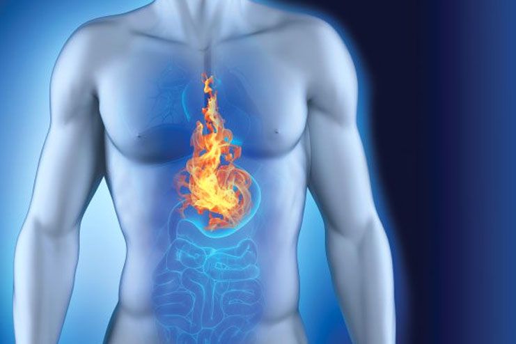 Hot Water for Acid Reflux