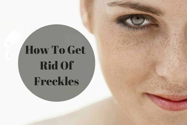 How to Get Rid of Freckles