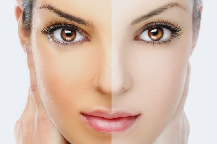 Vitamin C Serum for Skin Whitening