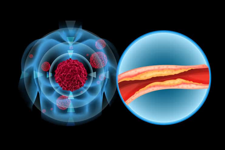 Cholesterol Levels