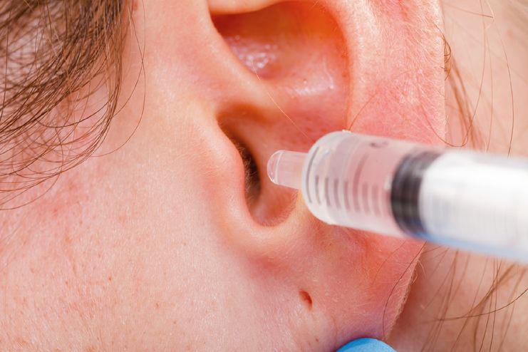 Rubbing Alcohol to Clean Earwax