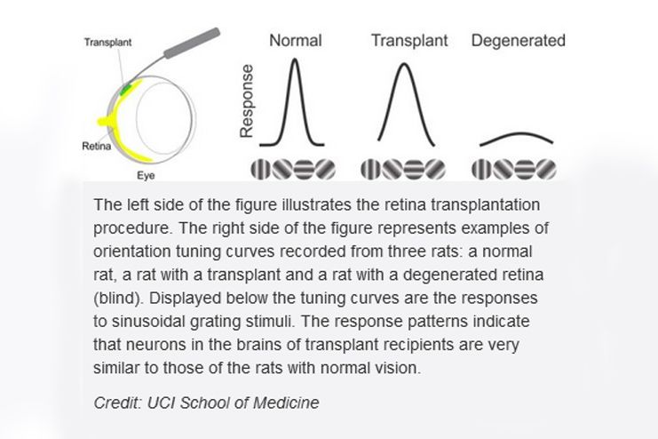 Cell-transplants