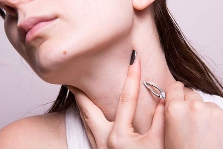 What causes skin tags