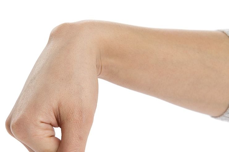 What is Ganglion Cyst