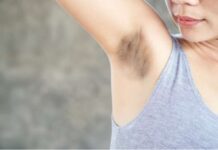 Effective Ways to Treat Dark Underarms and Restore Confidence Treat Dark underarms