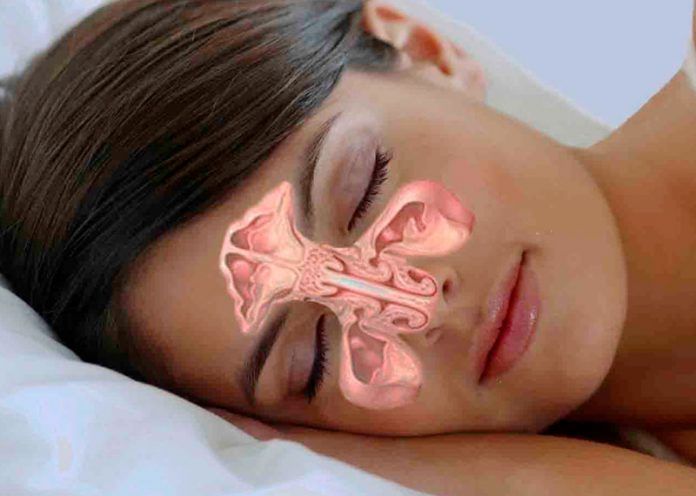 Natural remedies for sinusitis