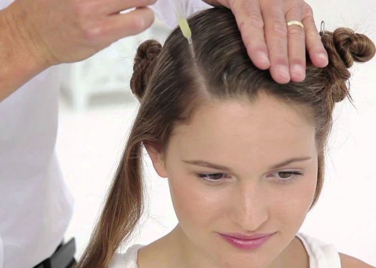 Home Remedies for Oily Scalp