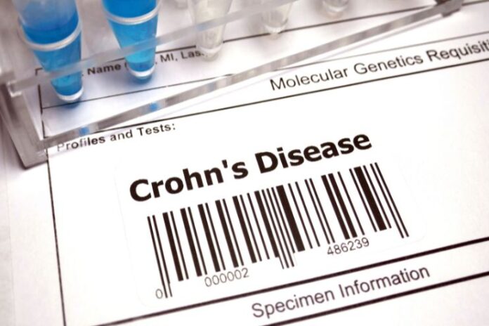 Treatment of Crohns Disease Through Diet