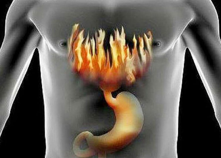 Effective Home Remedies for Acidity