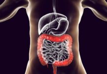 Heal Your Gut, Heal Your Life: 10 Natural Ways to Restore Your Digestive System Heal Your Gut Heal Your Life