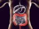 Heal Your Gut, Heal Your Life: 10 Natural Ways to Restore Your Digestive System Heal Your Gut Heal Your Life