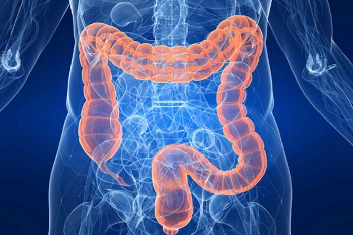 Colon health diet