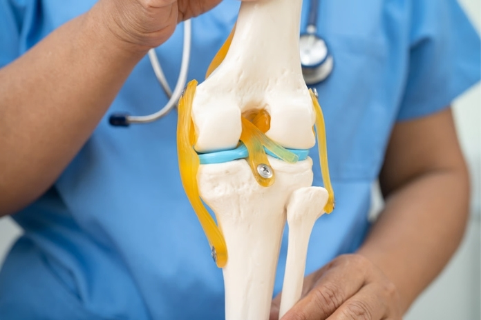 Natural Anti-Inflammatory Supplements for Osteoarthritis Natural Anti-Inflammatory Supplements for Osteoarthritis
