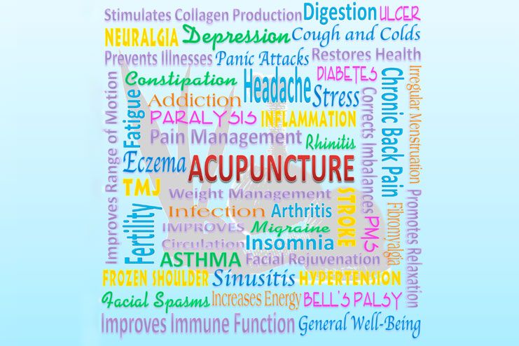 15 Acupuncture Benefits For Health and Wellness