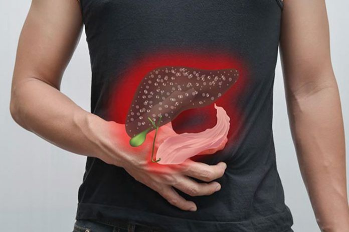 signs you have toxic liver