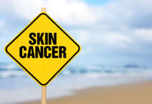 5 Early Signs of Skin Cancer 5-Early-Signs-of-Skin-Cancer