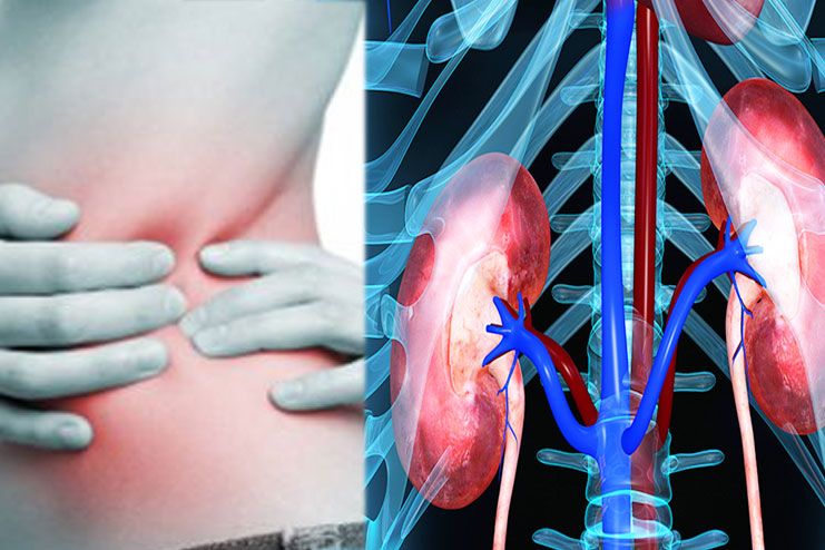 Kidney Infection Symptoms To Check