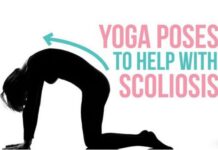 Top 6 Yoga Exercises for Scoliosis Top 6 Yoga Exercises for Scoliosis