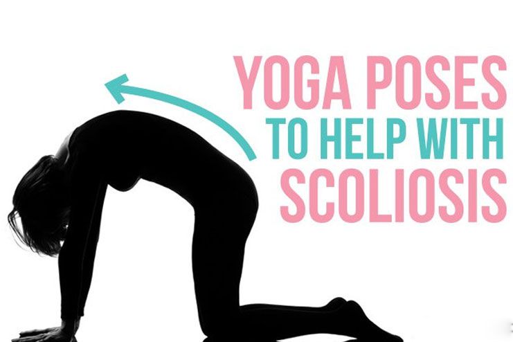 Top 6 Yoga Exercises for Scoliosis Top 6 Yoga Exercises for Scoliosis