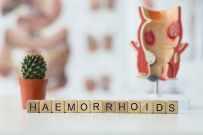 Hemorrhoids - Causes, Symptoms,